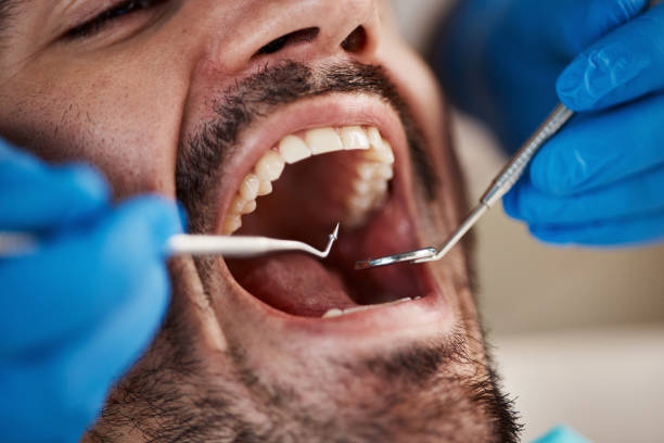 Best Emergency Dentist for Knocked-Out Tooth in Westmoreland, TN